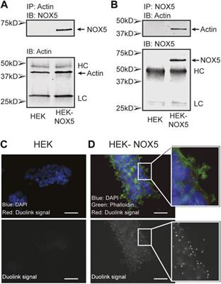 Functional interactions between NADPH oxidase 5 and actin